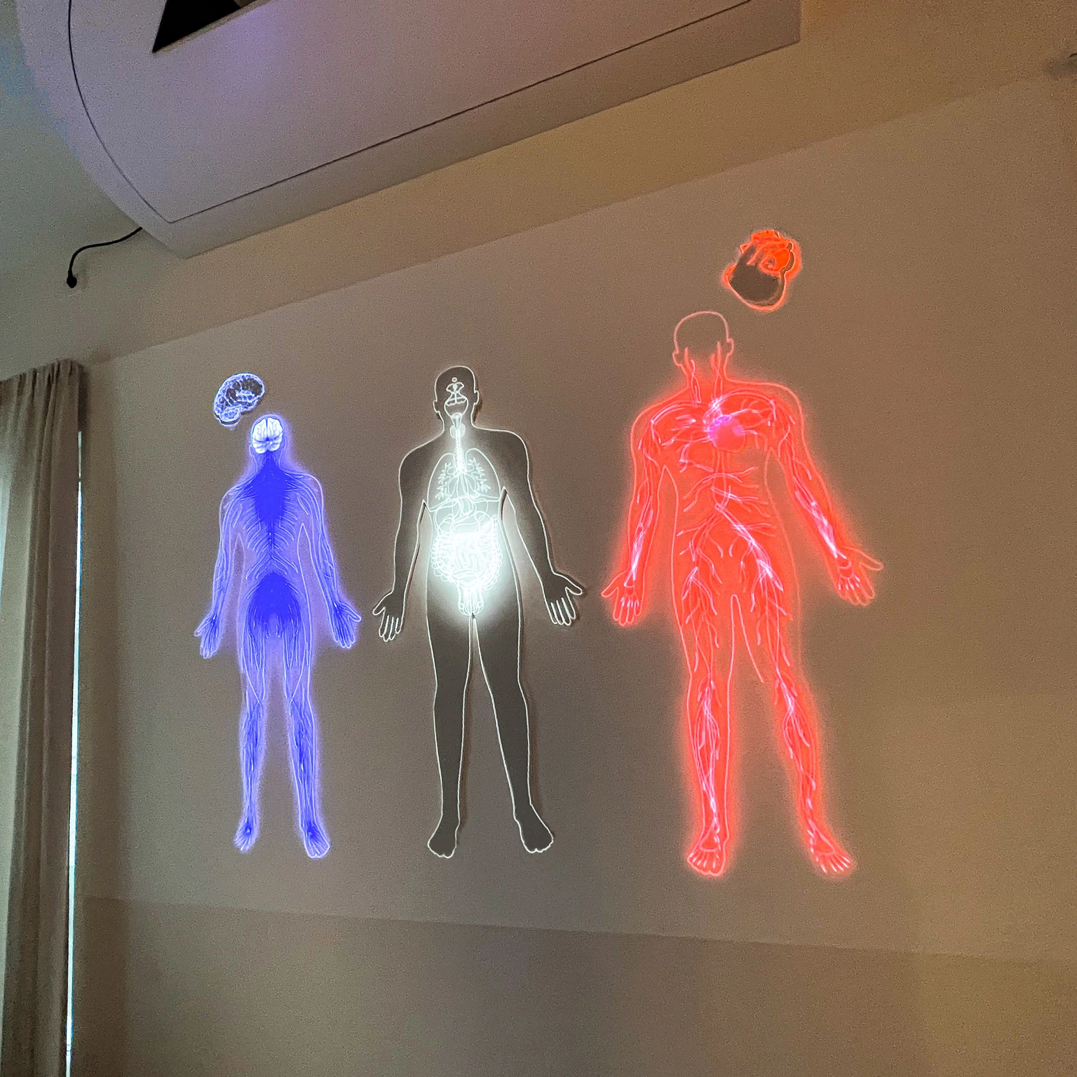Augmented Sculpture als ganzheitlicher Therapieansatz: die Video-Projektionen zeigen eine Darstellung von Herz, Gehirn und Organen und dienen somit als Visualisierung-Impuls